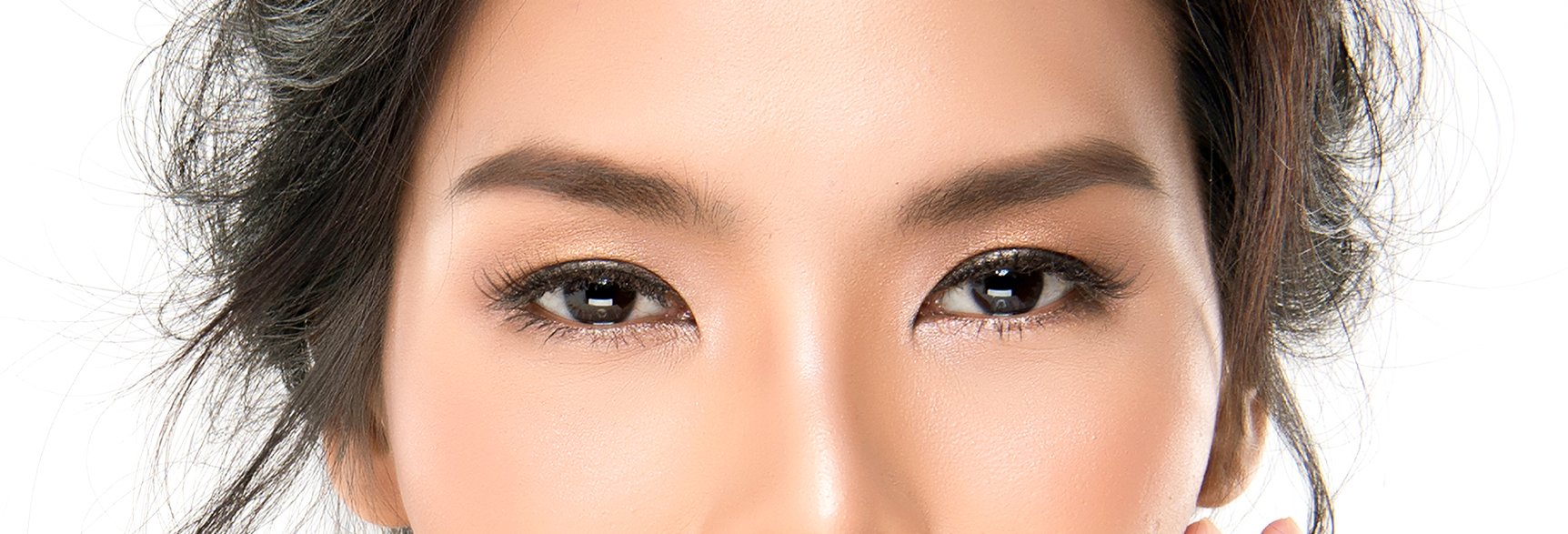 Double Eyelid Surgery