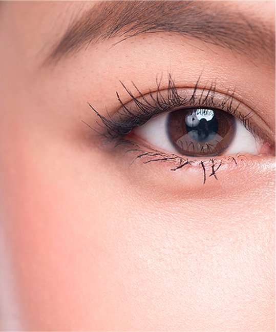 Scarless Eyelid Surgery