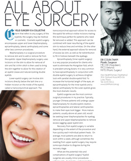 All About Eye Surgery