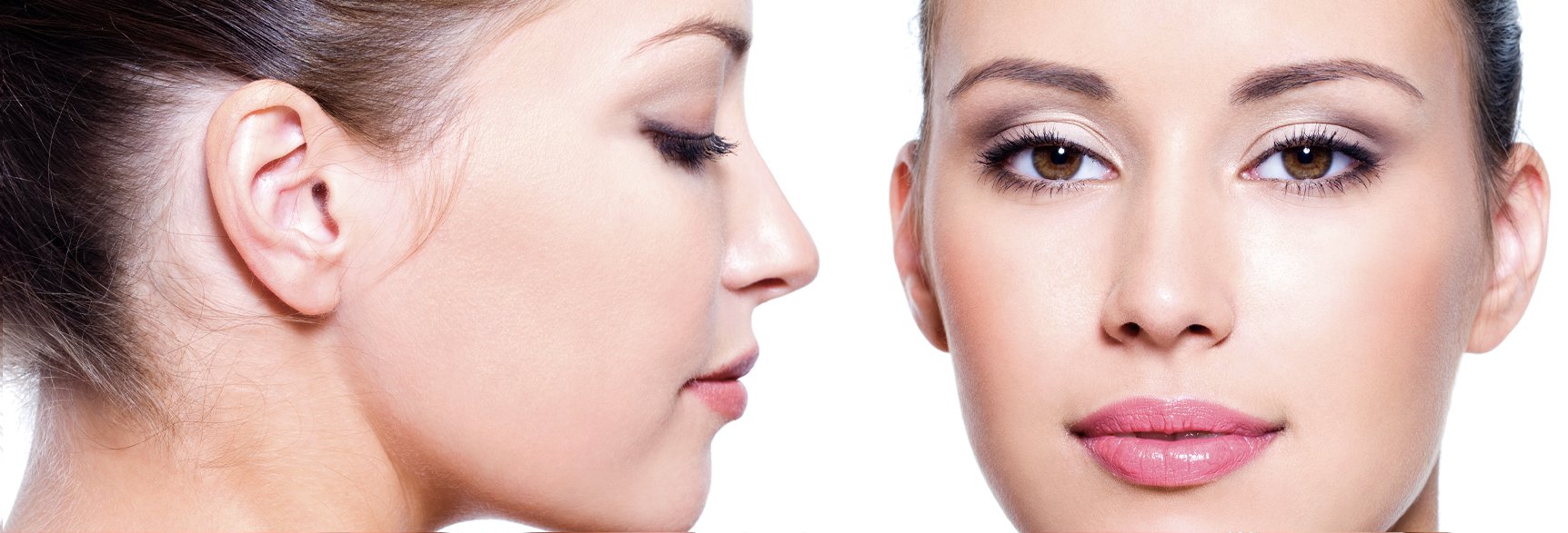 Rhinoplasty