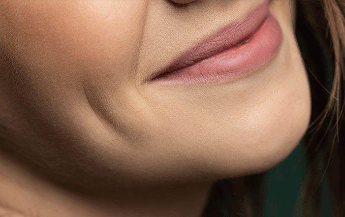 What does dimple-plasty involve?