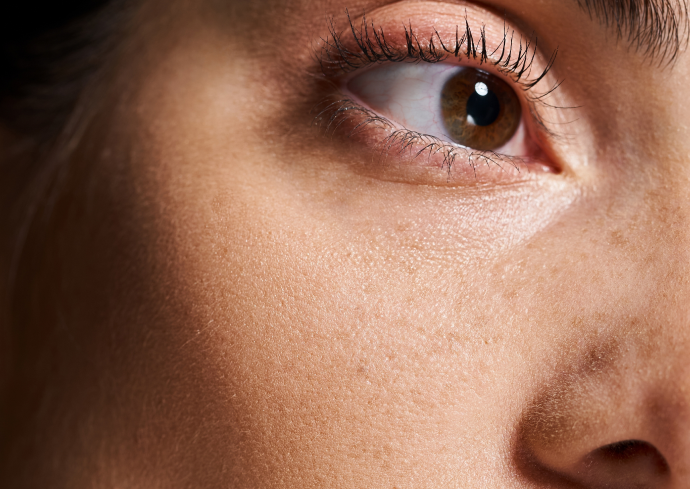 What Are Eyebags?